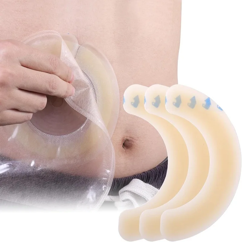 20pcs Ostomy Barrier Strips | Skin Adhesive, Grade Hydrogel, Leakage, Elastic Stoma Fixing Strip for Ostomy, Colostomy