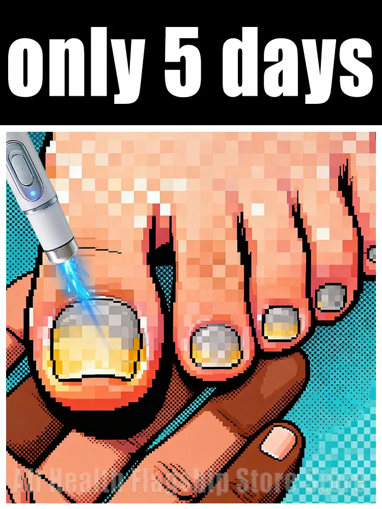 

The fifth generation of champagne-colored nail laser penʜᴇʟᴘs ʏᴏᴜ sᴀʏ ɢᴏᴏᴅʙʏᴇ ᴛᴏ ᴏɴʏᴄʜᴏᴍʏᴄᴏsɪs. Tᴇᴄʜɴᴏʟᴏɢʏ ᴄʜᴀɴɢᴇs ʏᴏᴜʀ ʟɪharᴇ。