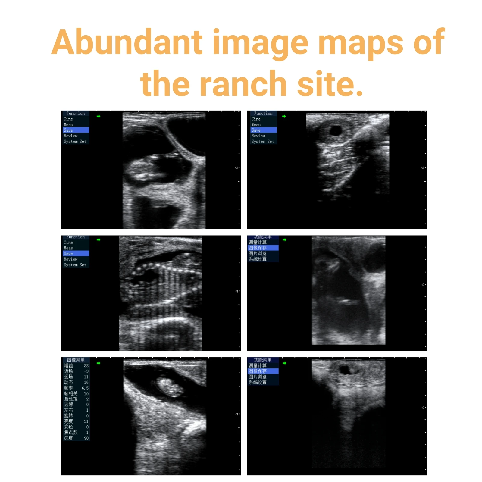 Handheld Wireless Ultrasound Device – Portable Electronic Ultrasonic Equipment for Clinical Diagnosis
