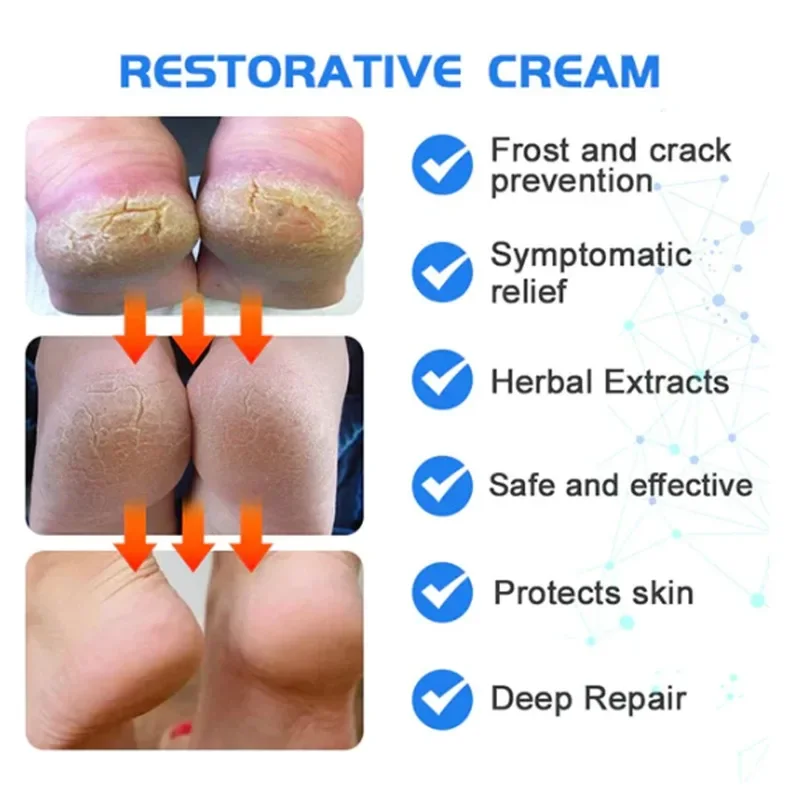 Severe Cracked Heel Repair Restoring Balm ป้องกันส้นเท้าแตก Repair Moisturizing Nourishing Stick Hand Feet Care 40g