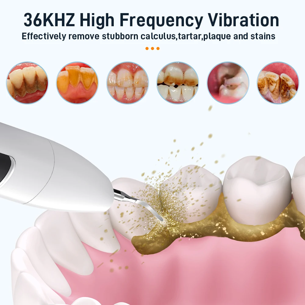 Schoben ablatore dentale ad ultrasuoni per denti tartaro macchia dente calcolo rimozione elettrico Sonic denti placca Cleaner rimozione della pietra