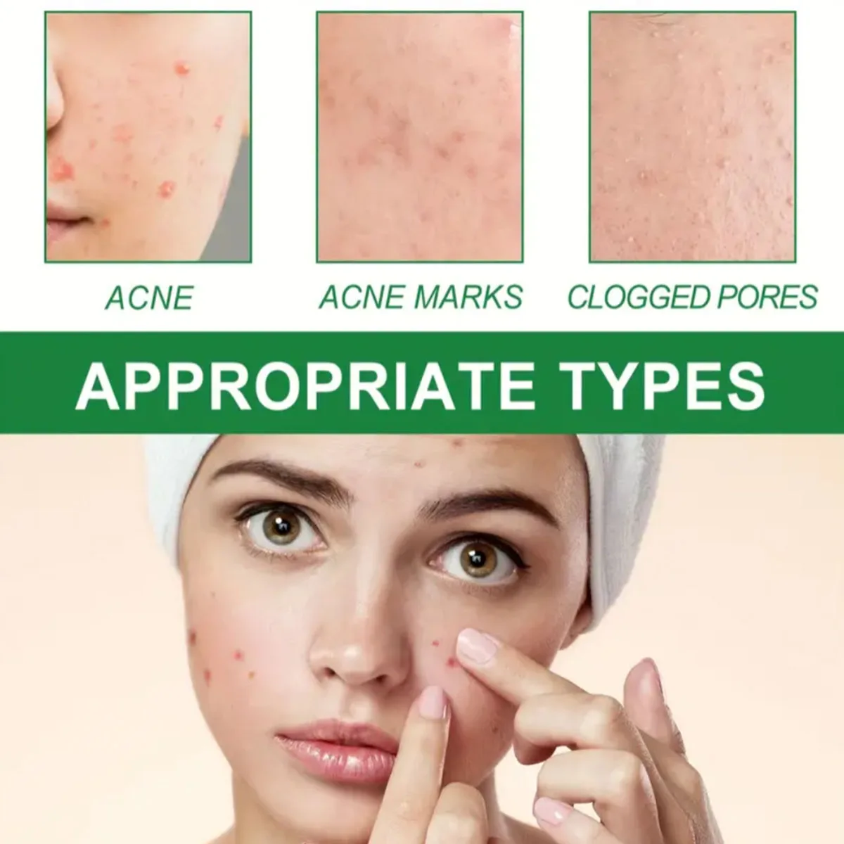 Olive oil for acne-removing acne marks to lighten facial acne marks