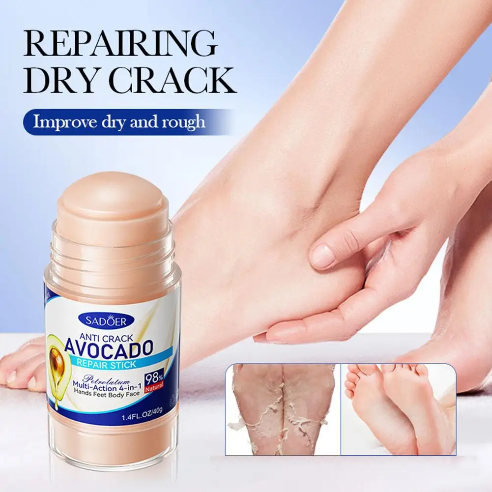 

40g Remobing Dead Skin And Callus Cracked Feet Cream Care Repairing Cream Feet Hand Feet Stick Moisturizing Cracked Y8V8