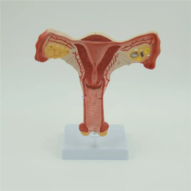 Uterus and Ovary Anatomical Model Human Female Medical Anatomy Internal Genital Organ