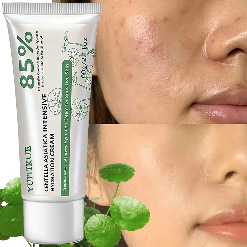YUITIKUE Centella Asiatica Intensive Hydration Cream 60g 85% Natural Formula for Deep Moisturizing & Sensitive Skin