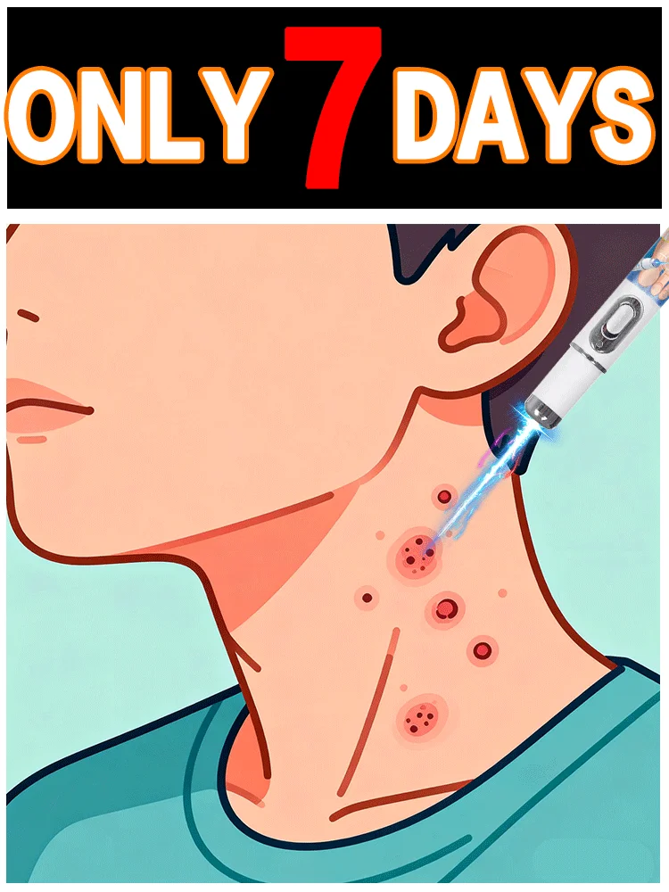 

With blue pen auxiliary tool body wart tool can meet your skin care needs.