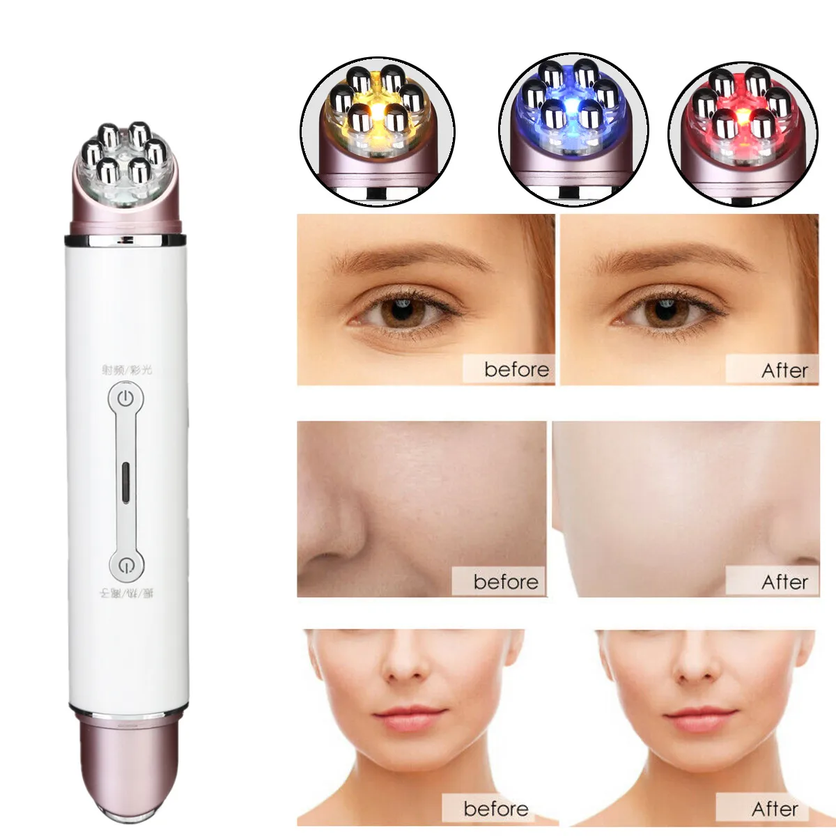 

EMS Radio Mesotherapy Electroporation Face Beauty Pen Double Head LED Photon Face Skin Rejuvenation Wrinkle Remover