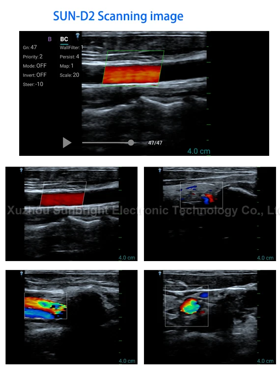 color doppler USB probe SUN-D2 ultrasound for phone