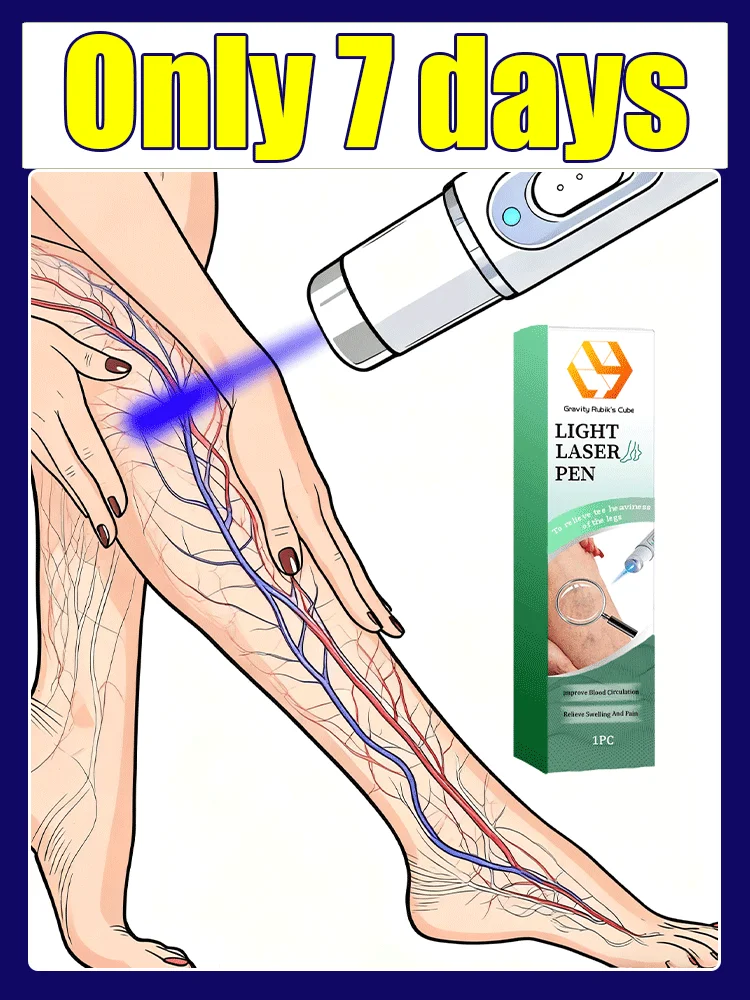 Patas de araña mejoradas de tercera generaciónReparación de raíz de venas varicosas uickly