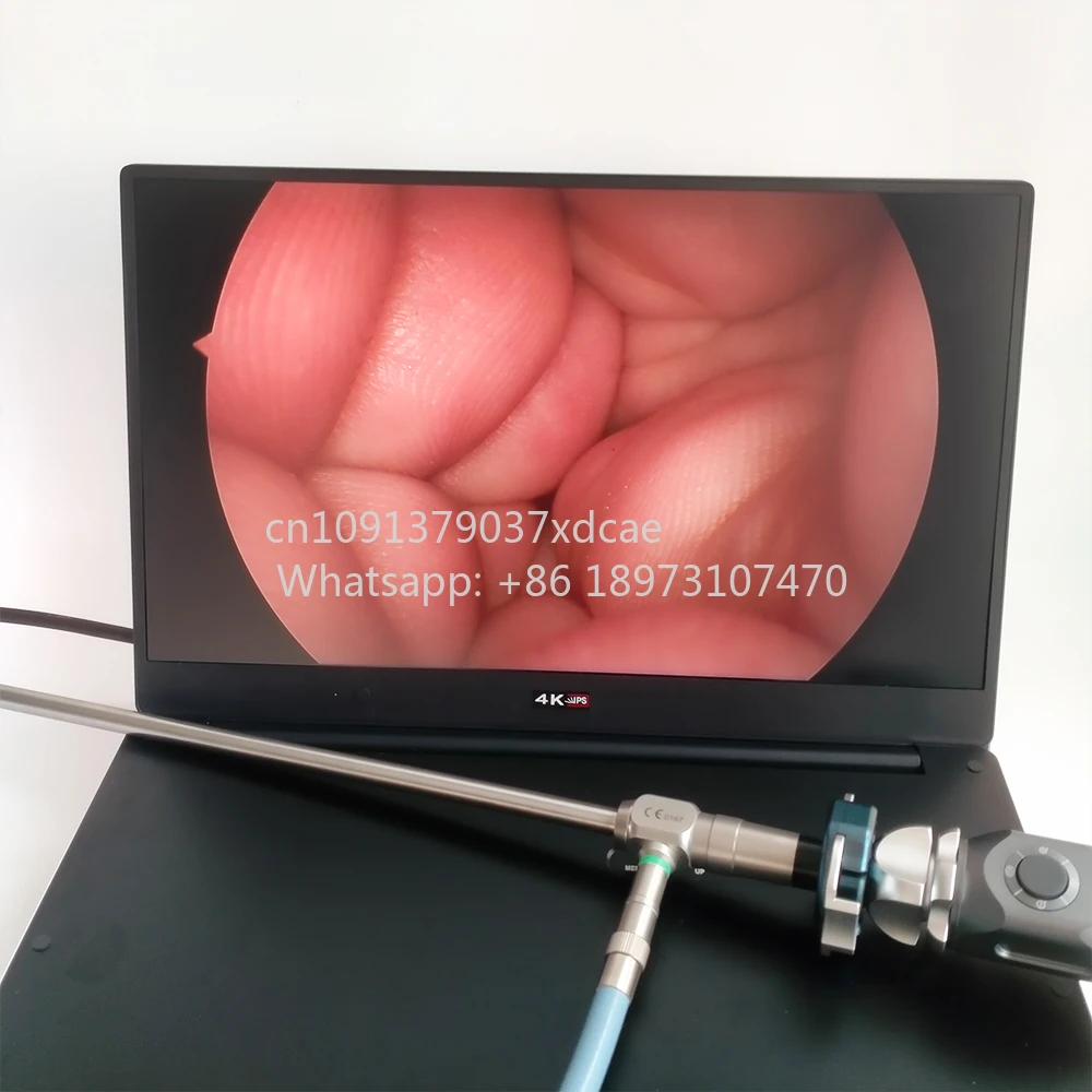 CY2200 . Portable Full HD 1080P Endoscope Camera System With 15.6 Inch Monitor, 100W Led Light Source And Record Function
