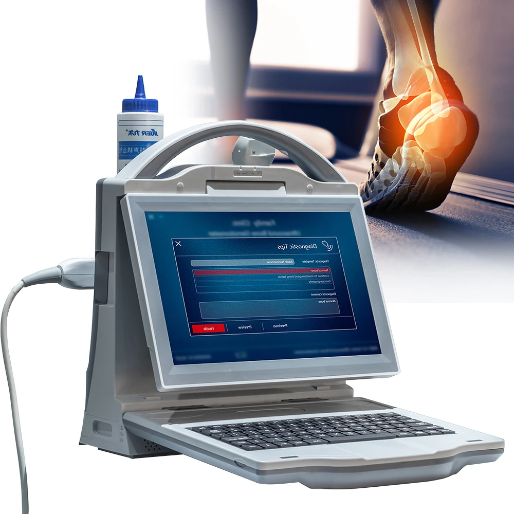 Medical Diagnostic Ultrasonic Bone Density Scanner Ultrasound Bone Densitometer