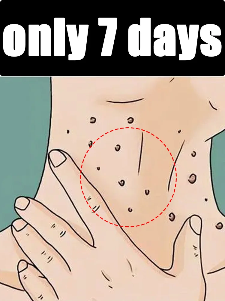 

Generation-2 equipment Says Goodbye To Your Troubled In 7 Days