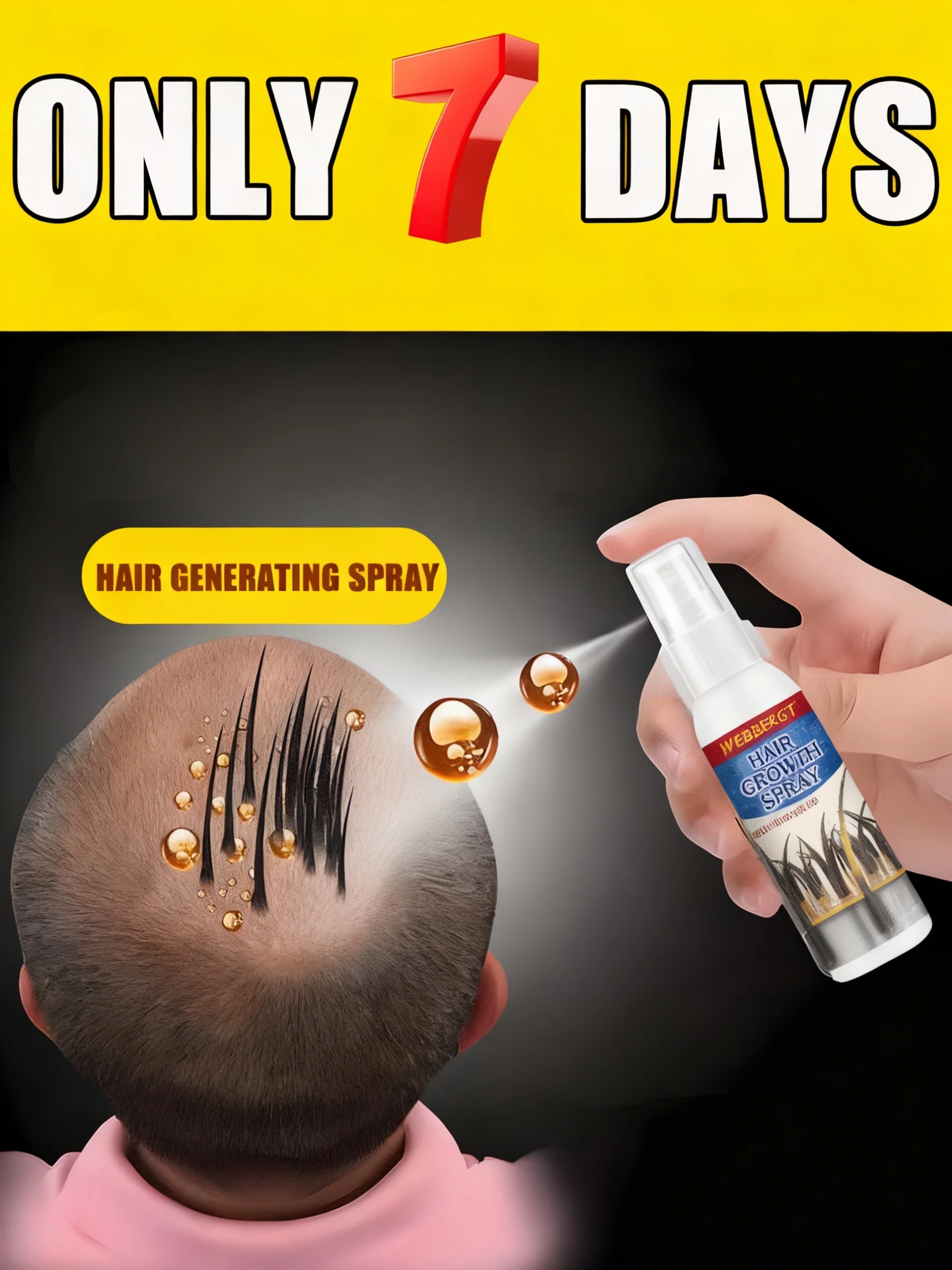 

Bᴀʟᴅɴᴇss ᴡᴏʀʀɪᴇs Hᴀɪʀ ɢʀᴏᴡᴛʜ sᴘʀᴀʏ ᴘʀᴏᴍᴏᴛᴇs ʜᴀɪʀ ɢʀᴏᴡᴛʜ ɪɴ 7 ᴅᴀʏs