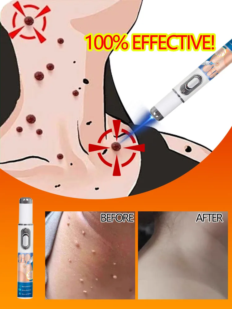 Migliora prima della fine luglio. Idratare e idratare la pelle.