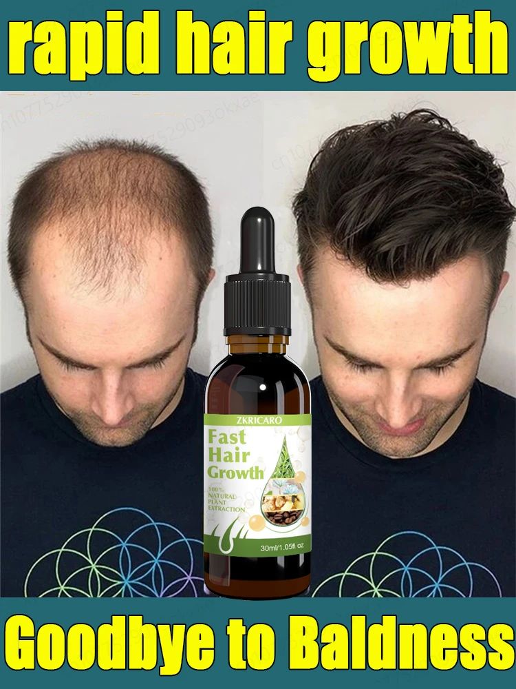 

Hair growth essential oil. Effectively repair baldness and hair loss symptoms