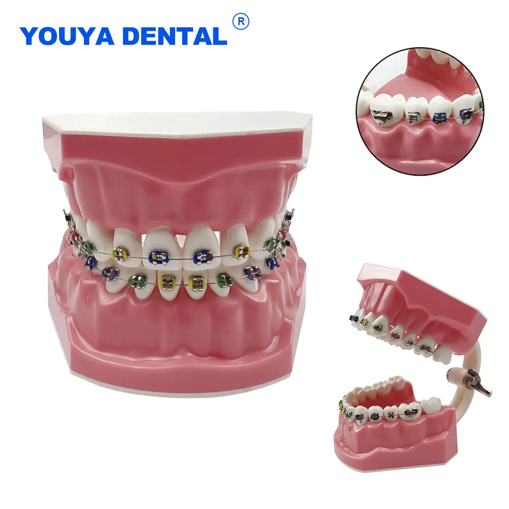 

Ортодонтическая зубная модель с брекетами, типодонт 1:1, для обучения и демонстрации стоматологических процедур