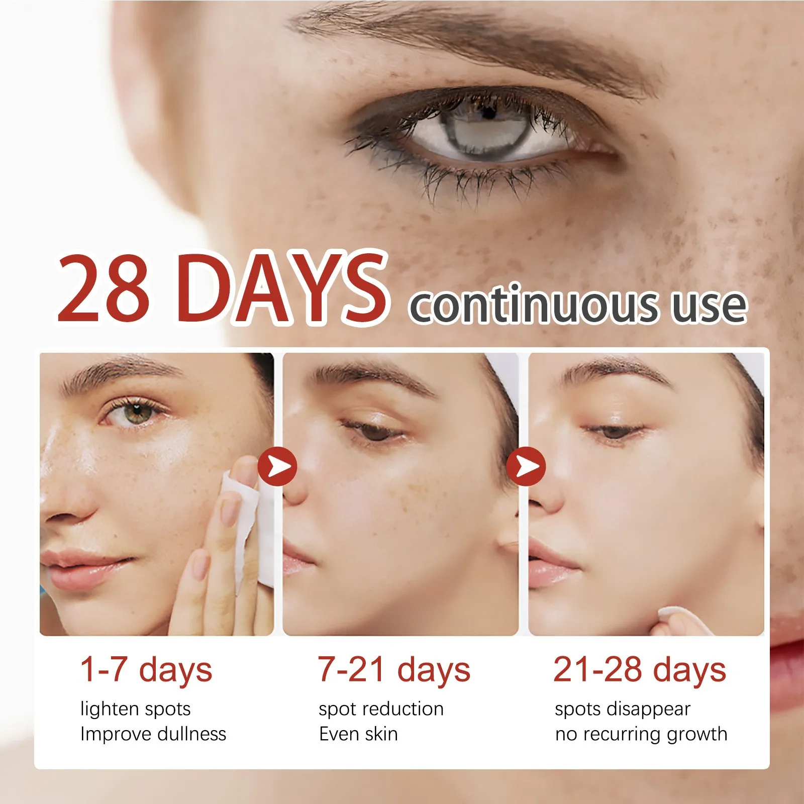 Pigmentation Care Cream Moisturizing And Nourishing Reduce Freckles Dark Spots Spots Chloasma Skin Rejuvenation And Beauty Cream