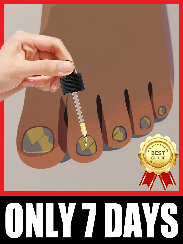 Bᴏᴛᴀɴɪᴄᴀʟ-Bᴏᴏsᴛᴇᴅ Fᴏʀᴍᴜʟᴀ ᴛᴏ Wɪᴘᴇ Oᴜᴛ Fᴜɴɢɪ & Rᴇɪɴᴠɪɢᴏʀᴀᴛᴇ Hᴇᴀʟᴛʜʏ Nᴀɪʟ Gʀᴏᴡᴛʜ, Fɪᴛs ғᴏʀ Hᴀɴᴅs ᴀɴᴅ Fᴇᴇᴛ, Tʀᴇɴᴅɪɴɢ ɪɴ 2025 #1