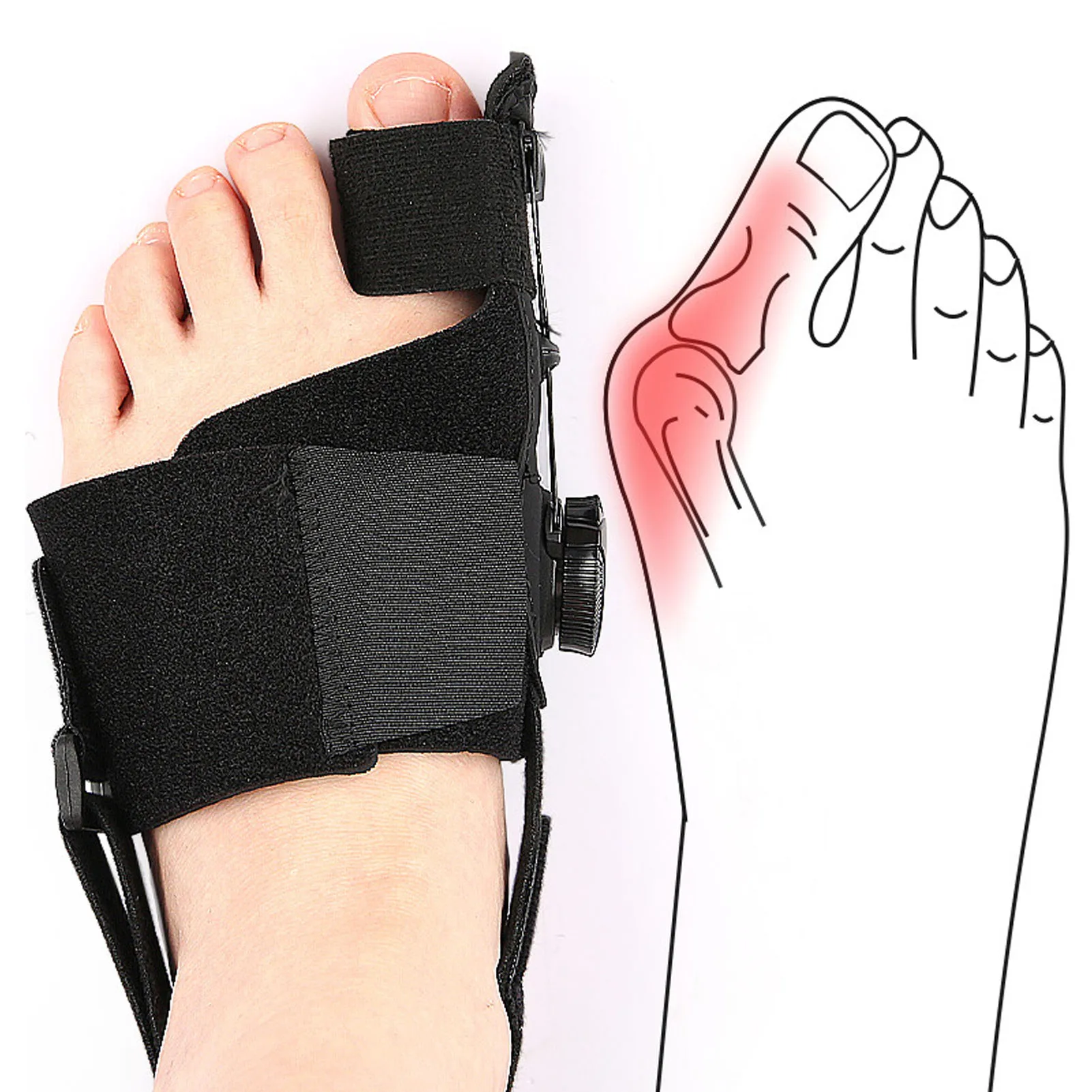 Big Toe Corrector Bunion Splint Bunion Corrector Orthopedic Big Toe Straightener Overlapping Toe Separator with Adjustable Knob