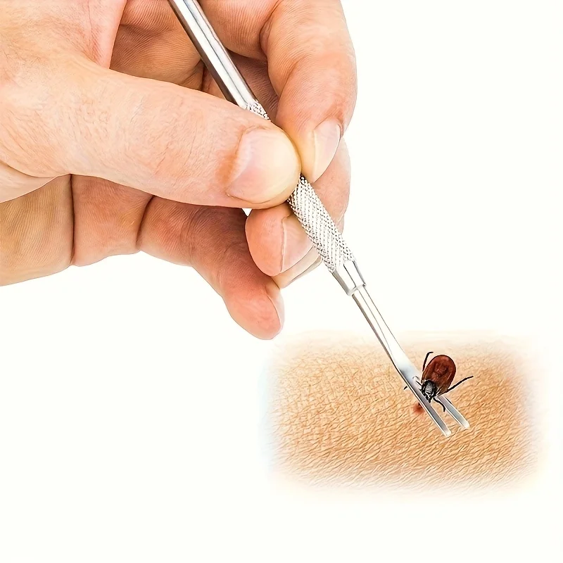 

1/2pcs Stainless Steel Tick & Flea Remover Pusher for Cats and Dogs Professional-Grade Prong Design with Ergonomic Textured Grip