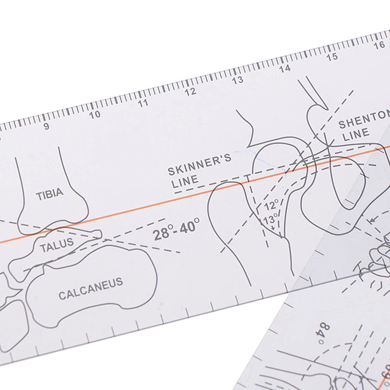 1PC Multi-Ruler Goniometer Angle Medical Ruler Joint Orthopedics Tool Instruments