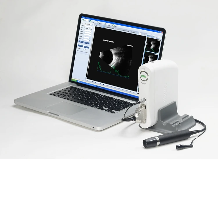 Newest A/B scan portable ophthalmic ultrasound MSLYZ09