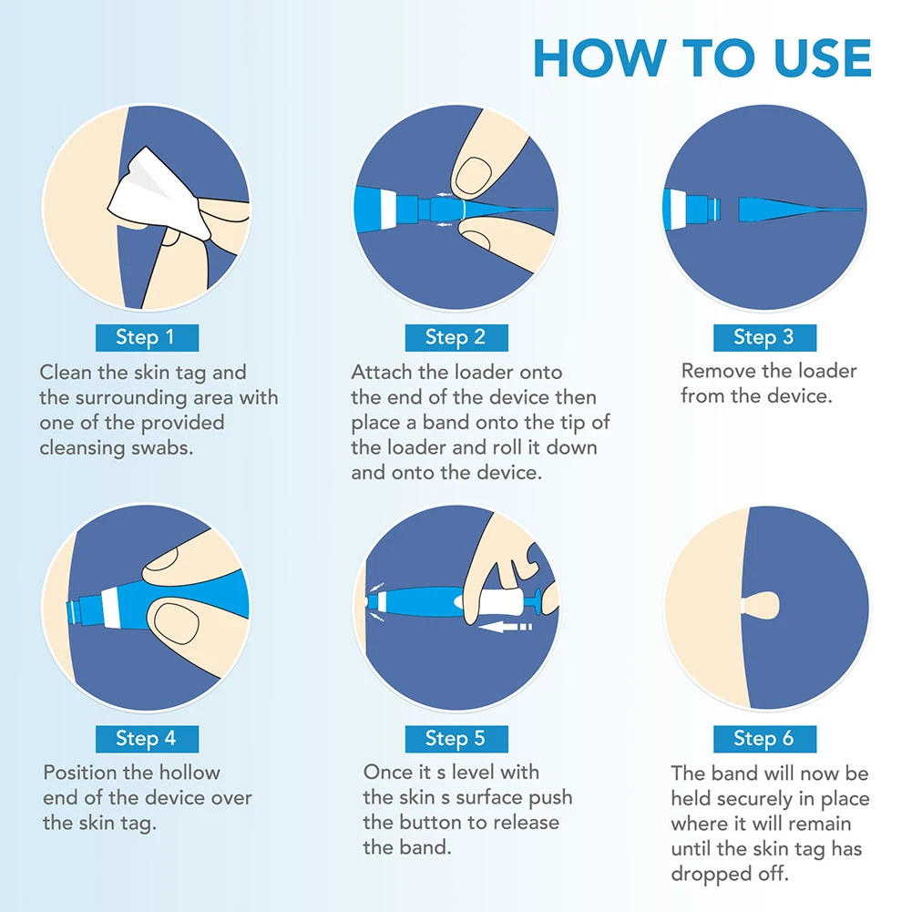 2-IN-1 السيارات الجلد علامة أداة إزالة الصواميل عدة غير مؤلم الجلد التسمية الخلد حب الشباب ثؤلول إزالة القلم مع مسحات التطهير أدوات العناية ببشرة الوجه #6