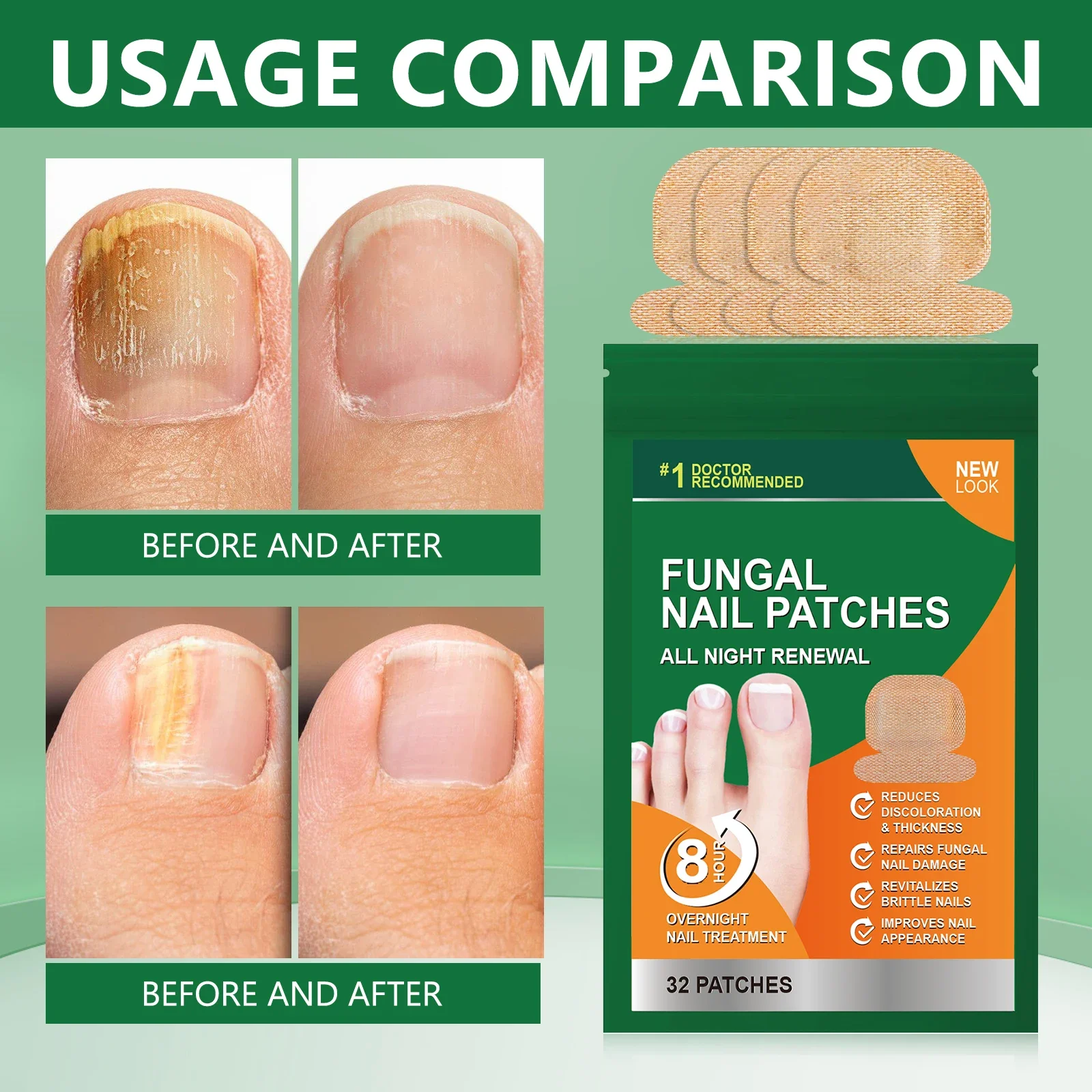 32 Stück Pilzreparatur-Nagelflicken. Reparieren Sie beschädigte Nägel. Verbessern Sie das Nagelaussehen. Stärken Sie spröde Nägel