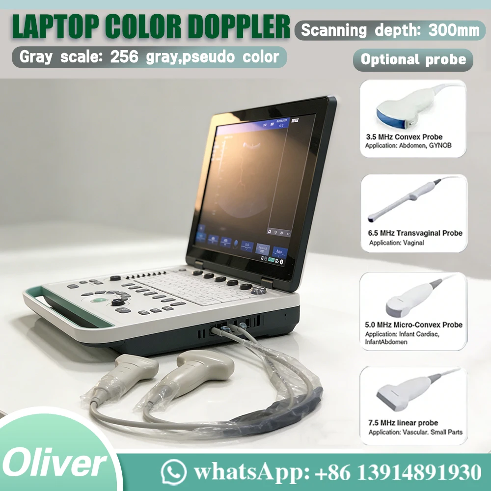 Escáner de ultrasonido portátil USG para computadora portátil de 15 pulgadas - Máquina de eco de diagnóstico Doppler en color con sonda lineal/convexa