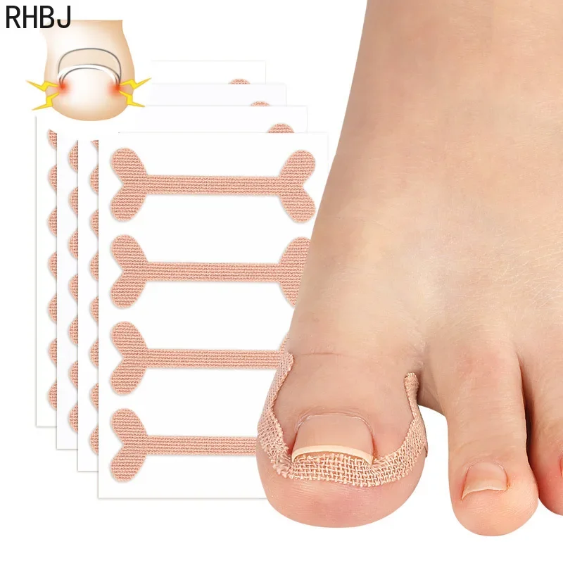 RHBJ New Toe Nail Groove Foot Nail Orthodontic Device Thumb Nail Patch  Pedicure Toe Nail Deformation Recover Foot Care Tools