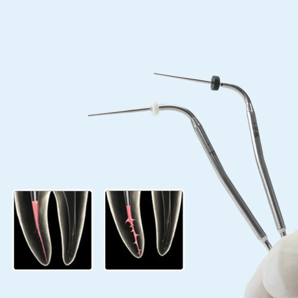 Dental Gutta Percha Heated Tips 4Pcs Size F FM ML Endodontic Tips for Root Canal Obturation & Endo System