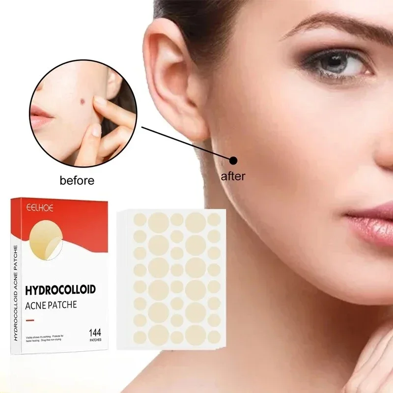 Hydrocolloid Acne Patch Facial Blemishes Pimple Marks Closed Acne Blemishes Cover Acne Pimple Repair Patch Invisible Acne Patch