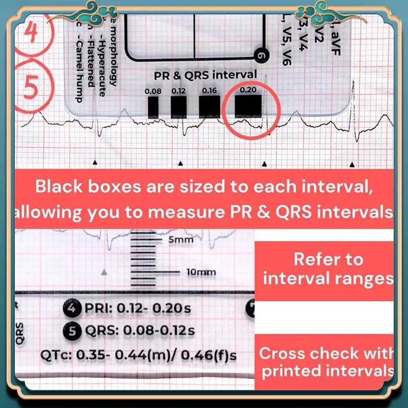 (Новинка) - Шаговая линейка ЭКГ 7, шаговая линейка ЭКГ для перевода ЭКГ/ЭКГ, инструмент для быстрого и быстрого анализа кардиологического анализа и измерения