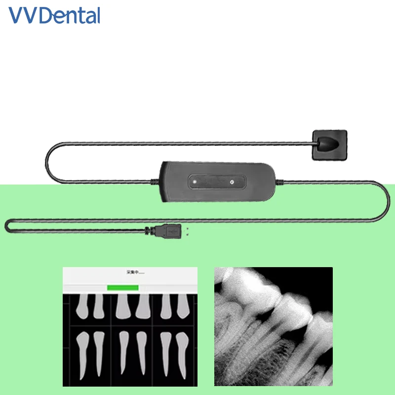 Dental Sensor Xray holder Intraoral Digital System HD lmaging Radiography Dentistry Equipment supply Portable Digital Oral Tools
