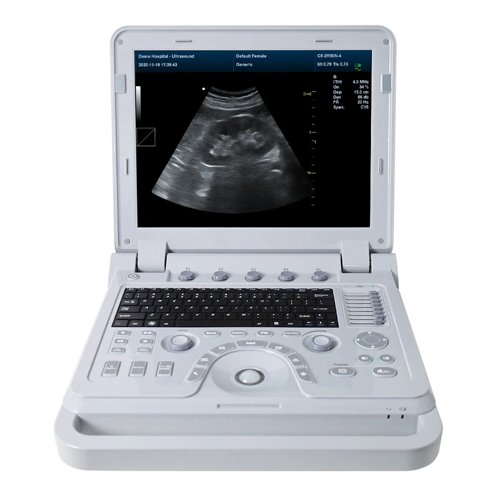 CONTEC CMS600P2 PLUS ultrasound pseudo color doppler ultrasound Pulse Spectral ultrasound