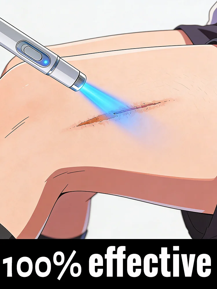 

Not just fades, but ᴄᴏᴍᴘʟᴇᴛᴇʟʏ ᴇʟɪᴍɪɴᴀᴛᴇs sᴄᴀʀs in 7 days.