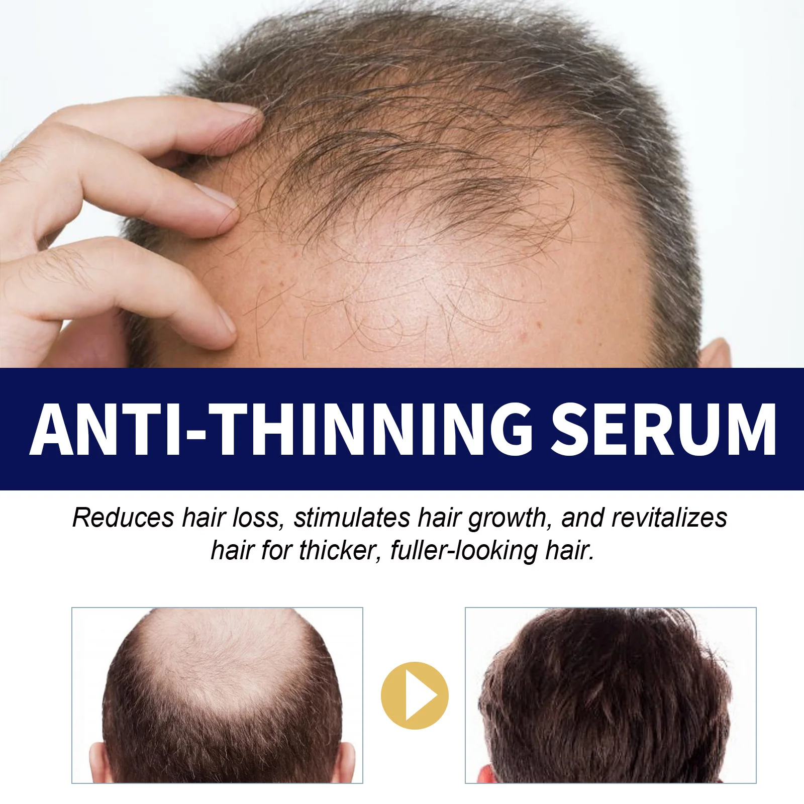 10 buah Serum penumbuh rambut, produk terbarukan Anti rambut rontok menutrisi akar rambut