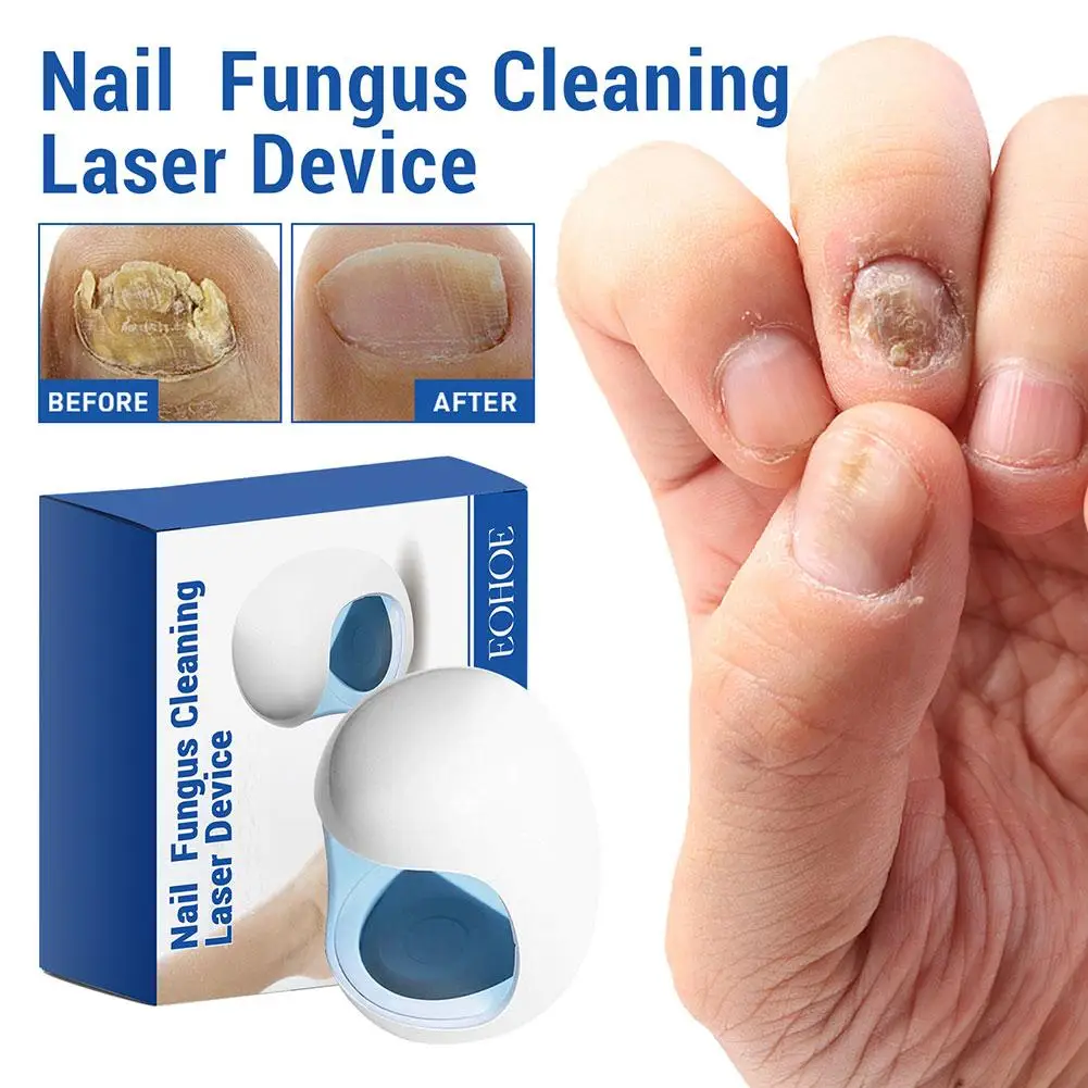 Fungal Nail Laser Device Repair Fast Nails Fungus Onychomycosis Nail Fungus Laser Cleaning Device Feet Health Care