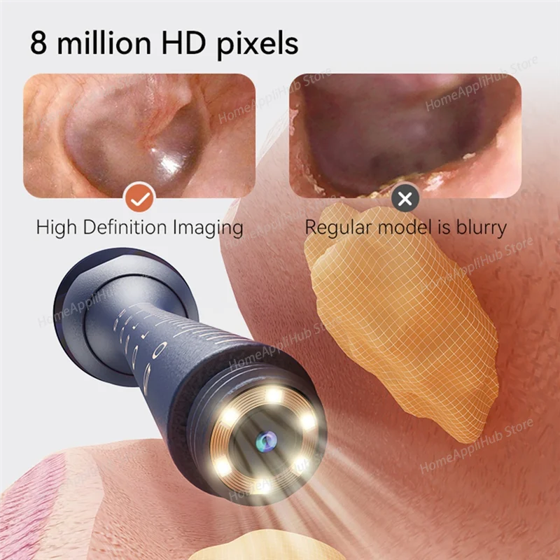 Smart Visual Ear Scorer, Wireless Ultra-clear Household Ear Cleaning Wonder,luminous Ear Scorer, Multi-functional in One Machine