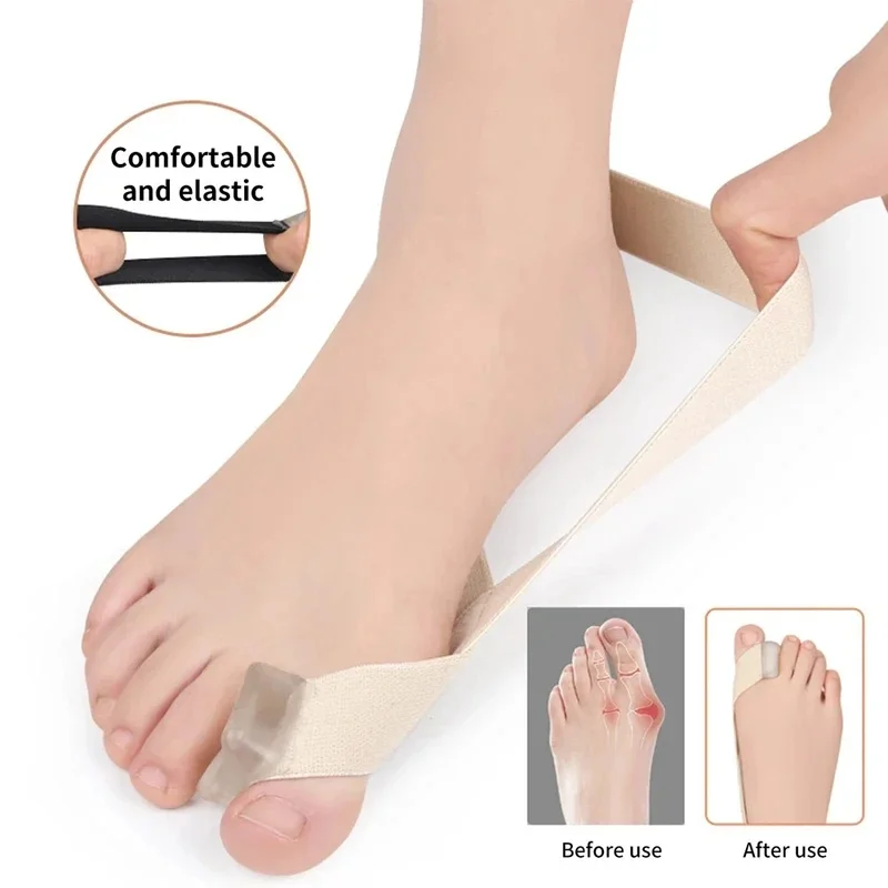 1-3pcs Foot Hallux Valgus Pull Strap Relieve Split Toe Orthosis Daily Wear Toe Separator Straightener Elastic for Foot Care
