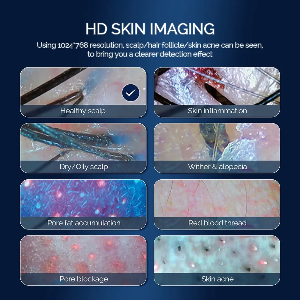 15 Inch HD Display 50/200X Professional Hair Follicle Detector Scalp Diagnostic Machine Skin Analyzer Oil Moisture Skin Tester