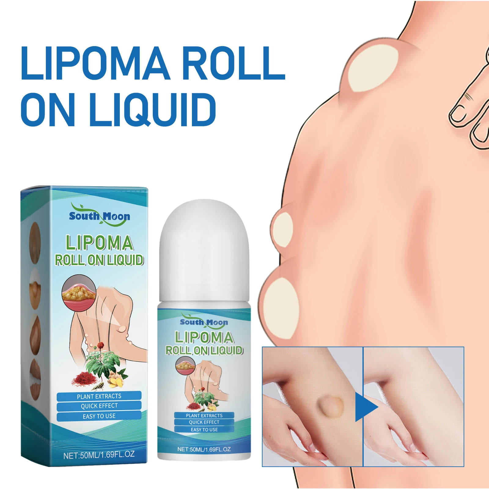 

Fat knot dredging spray body subcutaneous fat dredging to relieve lumps caking care agent