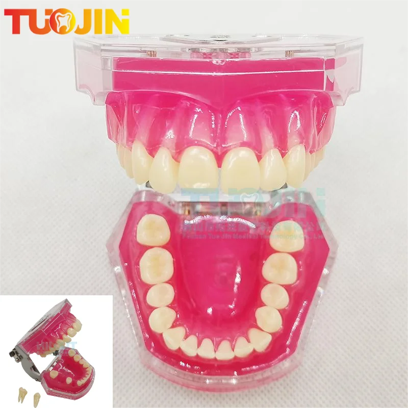 

New Dental Typodont Model With Removable Teeth Soft Gum Tooth Extraction Pratice Model Dental Models For Patient Education Demo