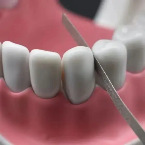 Imagen 2 del producto GULPOOE 12 unids/pack palos de Pulido de metales Dental chapado en aluminio de acero inoxidable tiras de pulido de un solo lado 4mm