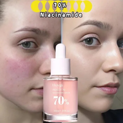 Aceite Facial hidratante antisecado que aumenta la elasticidad suavizante suave cuidado de la piel melocotón 70% suero de niacinamida 30ml