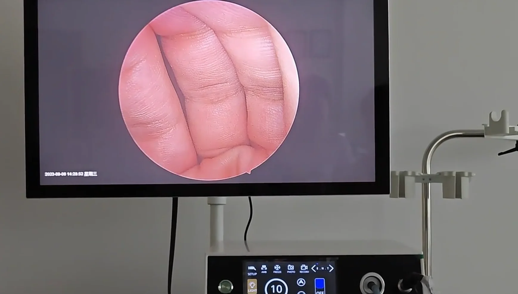 Full HD Touch Screen Endoscopic Camera System for ENT Laparoscopy Spine Surgery