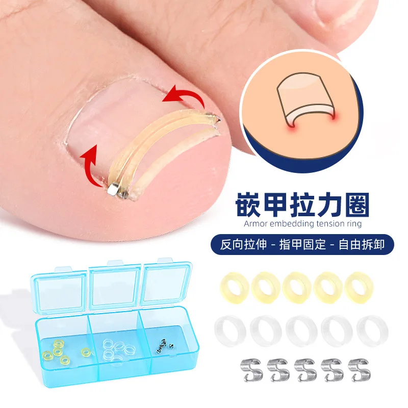 1 set of toe nail ring, stretch rebound nail groove, roll nail, physical reverse stretch, feasible walking, washable, reusable