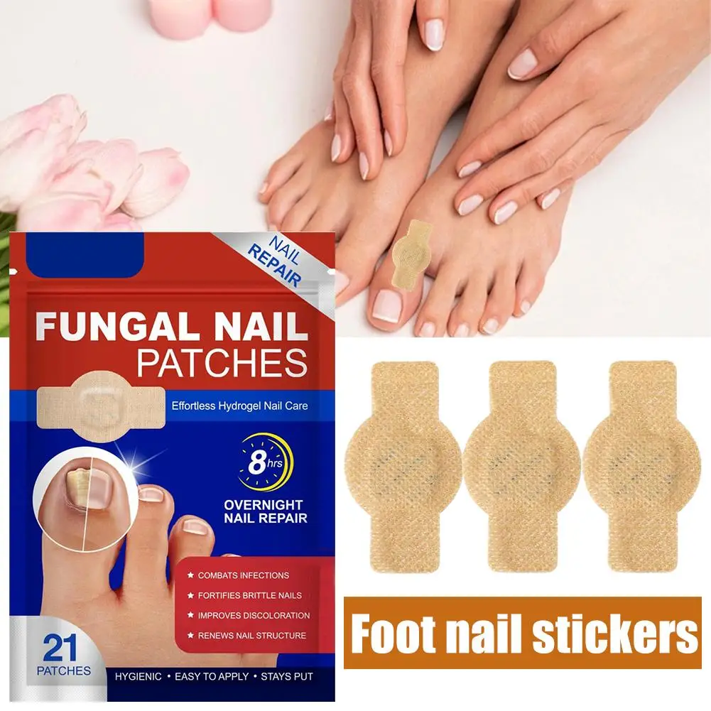 Patch de traitement des ongles, Patch champignon des ongles des pieds, Patch collant de réparation des ongles, épais, doux, Paronychia, Infection, 21 pièces