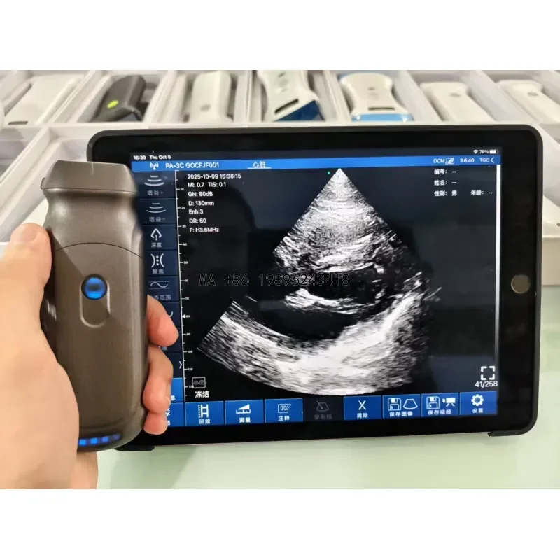 Wmwmnu for TL-X3 Handheld Wireless Color Ultrasound Probe Phased Array Heart Pocket Scanner Portable Diagnostic