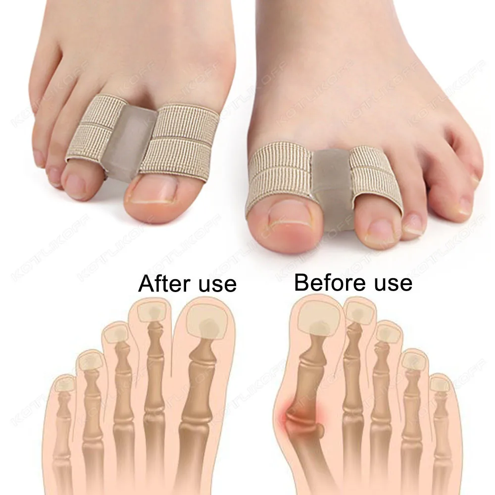 2PCS Silicone Two Hole Toe Separator Gel Foot Finger Protector Bunion Orthopedic Hallux Valgus Guard Straightener Pedicure